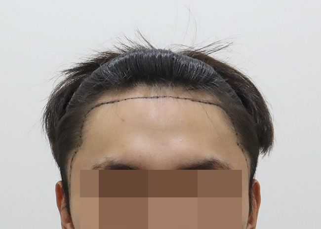 포토후기 이미지