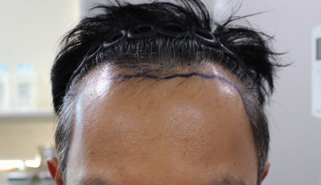 수술전3.JPG