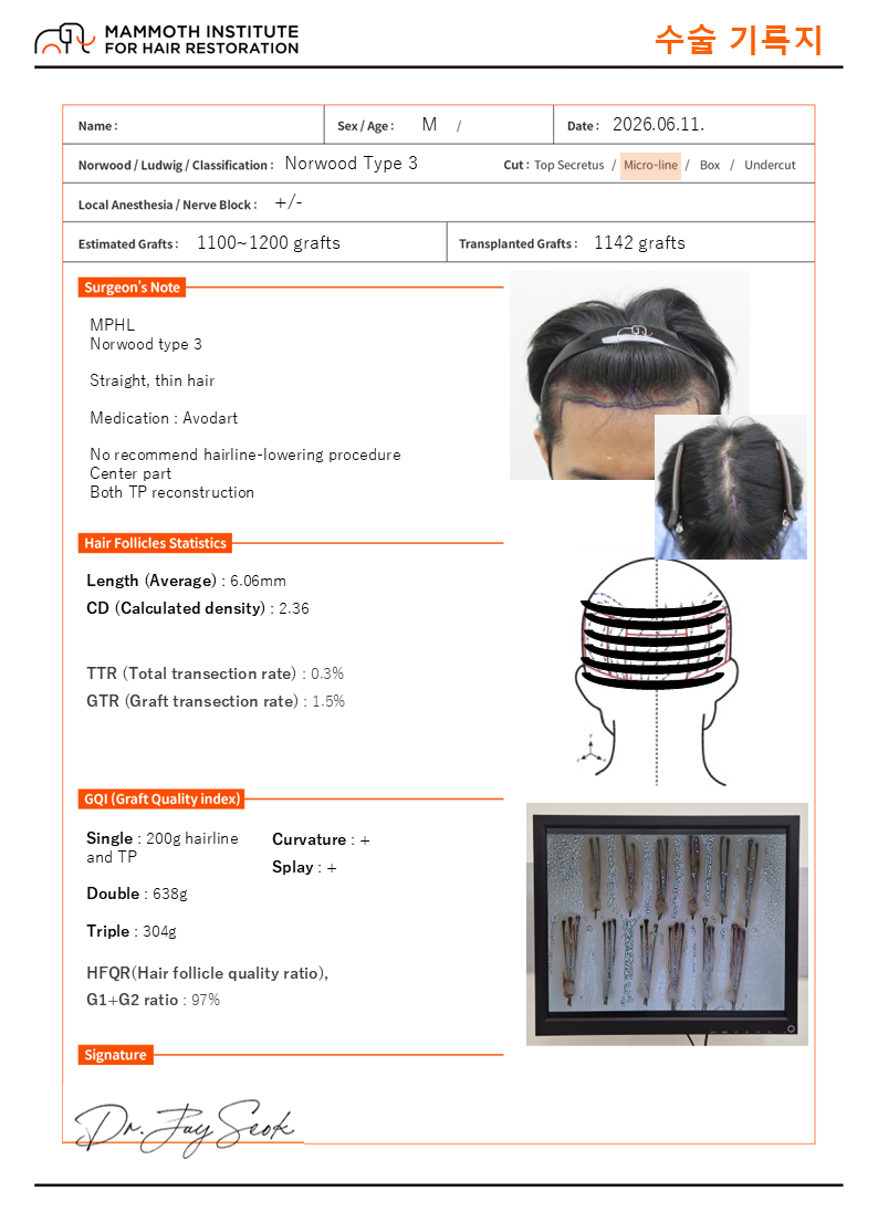 포토후기 이미지