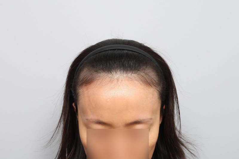 포토후기 이미지