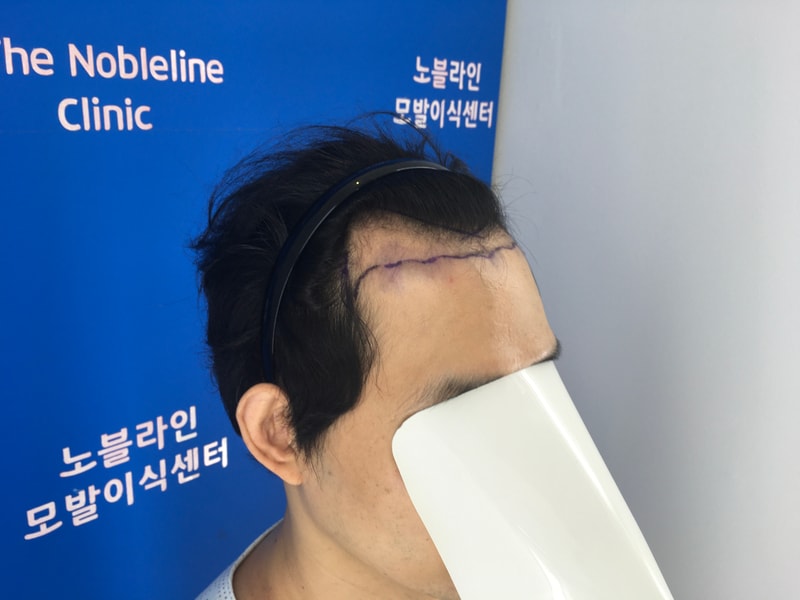 포토후기 이미지