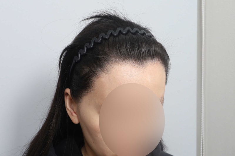 ★_2026041810364344012_원내경과.jpg
