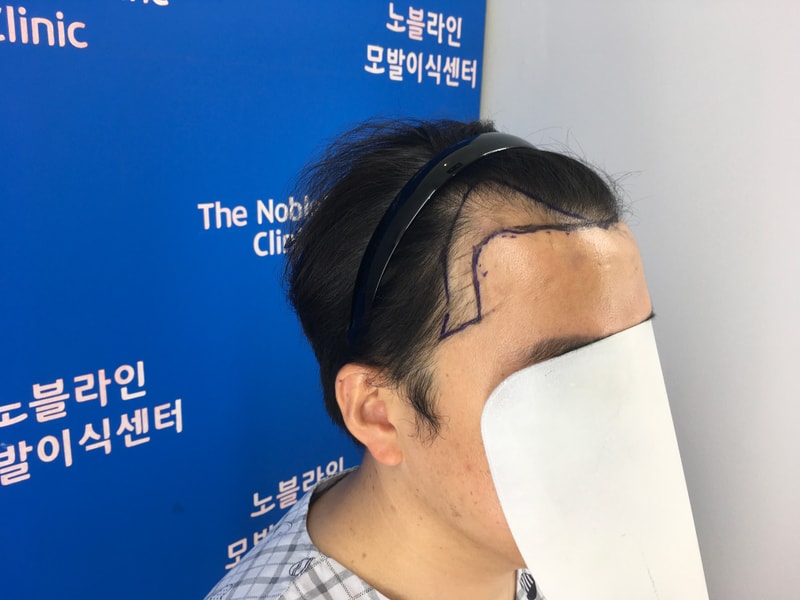 포토후기 이미지