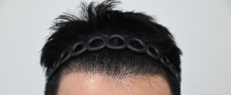 수술후3.jpg