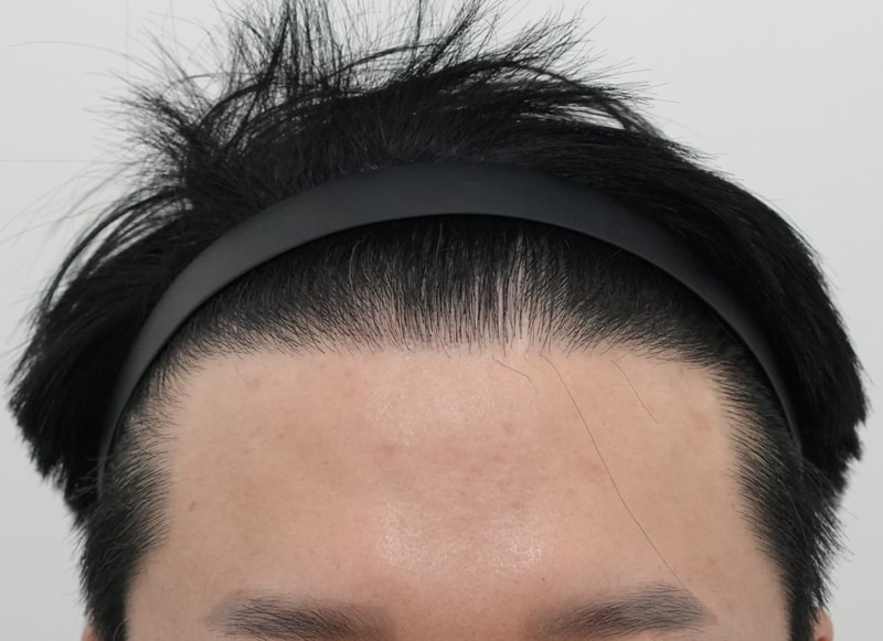 후.jpg