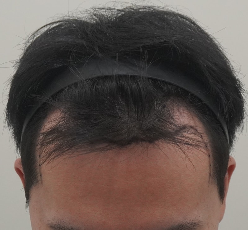 포토후기 이미지
