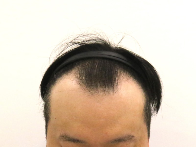 포토후기 이미지