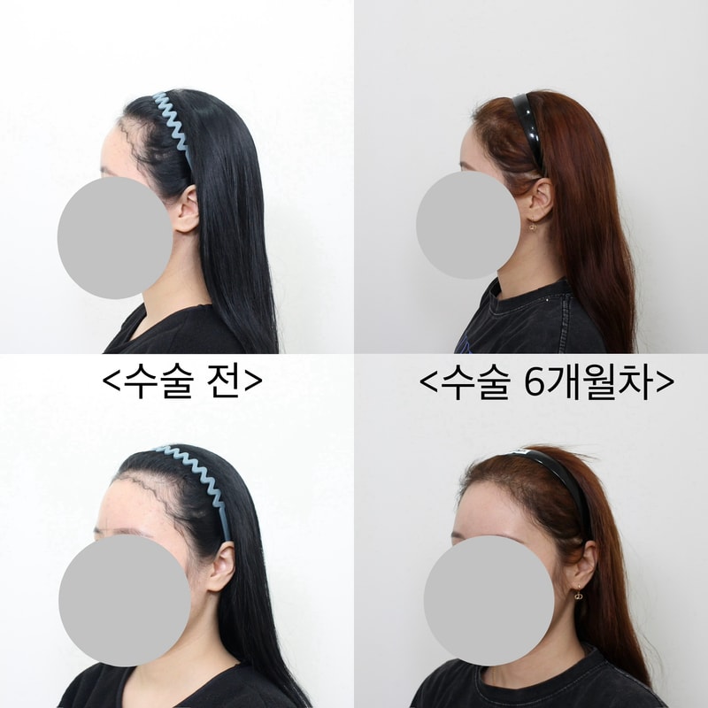 포토후기 이미지