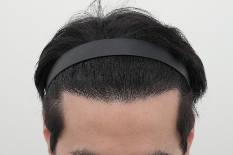 후.jpg