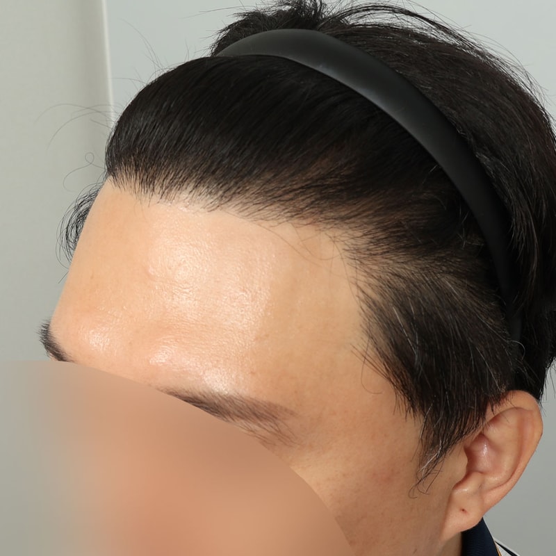 수술후 371일차 (1).jpg