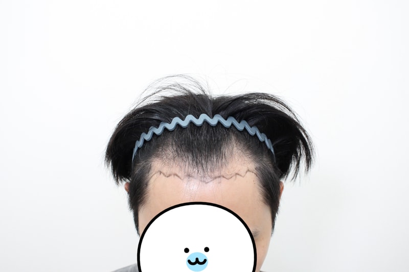 포토후기 이미지