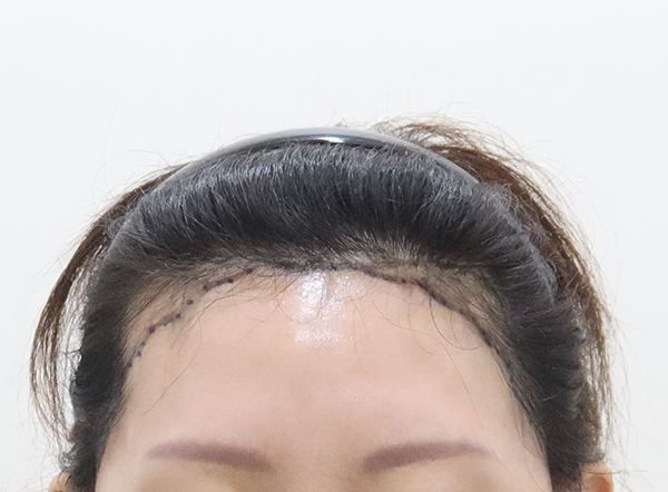 포토후기 이미지