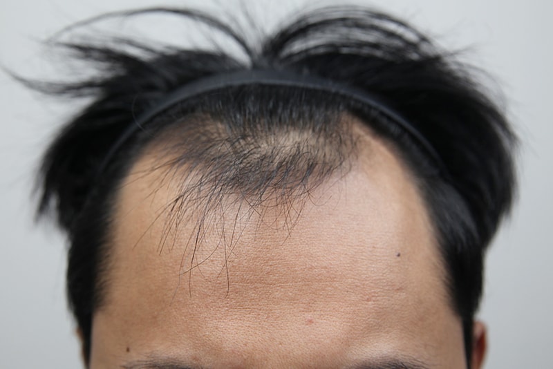 포토후기 이미지