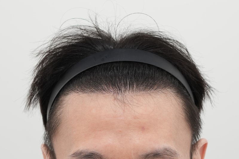 후1.jpg