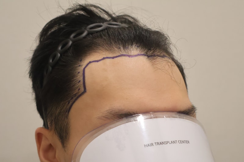 포토후기 이미지