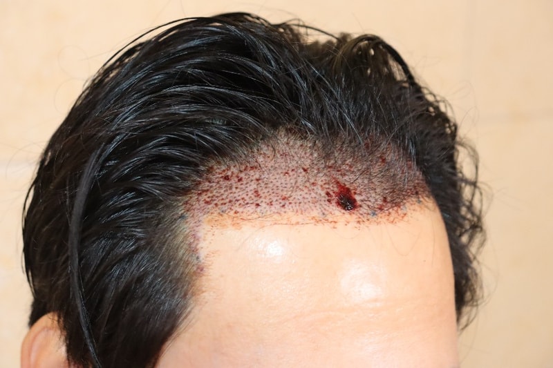 1000036096.jpg