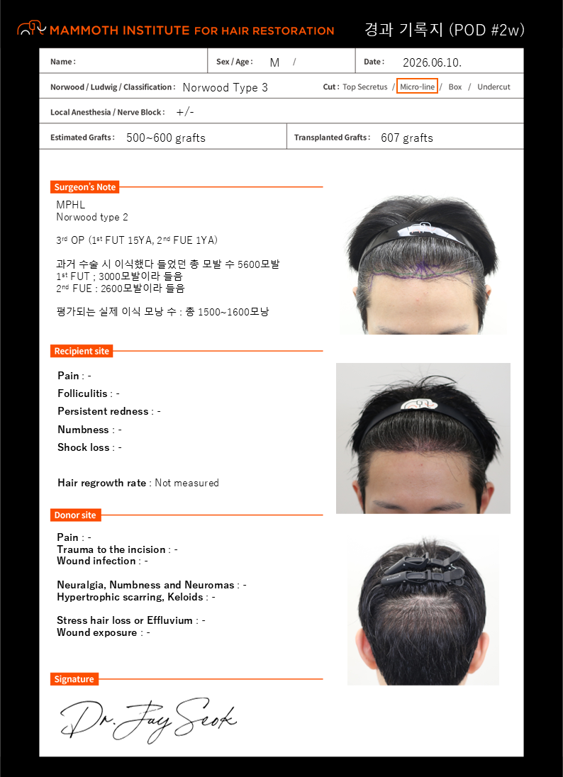 포토후기 이미지