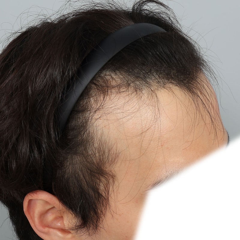 수술전2.jpg