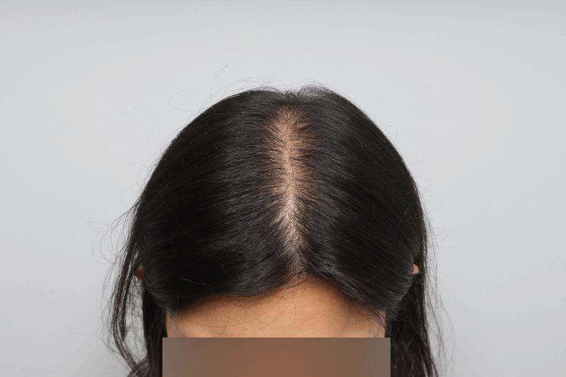 포토후기 이미지