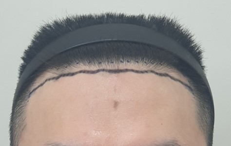 포토후기 이미지