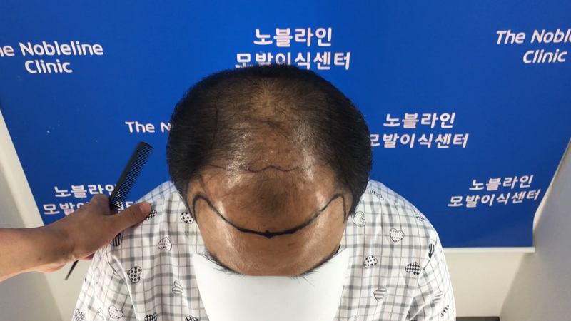 포토후기 이미지