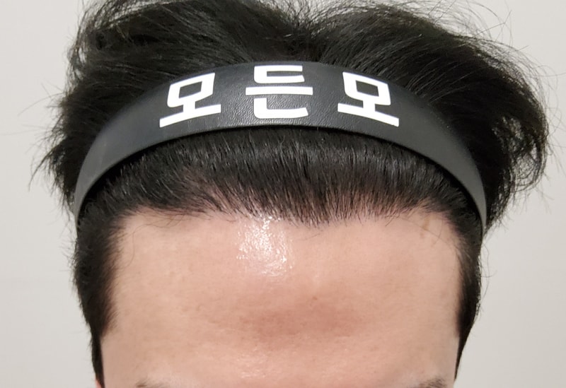 4. 수술후_1년_1.jpg