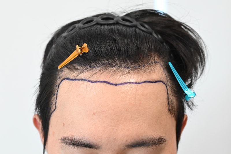포토후기 이미지