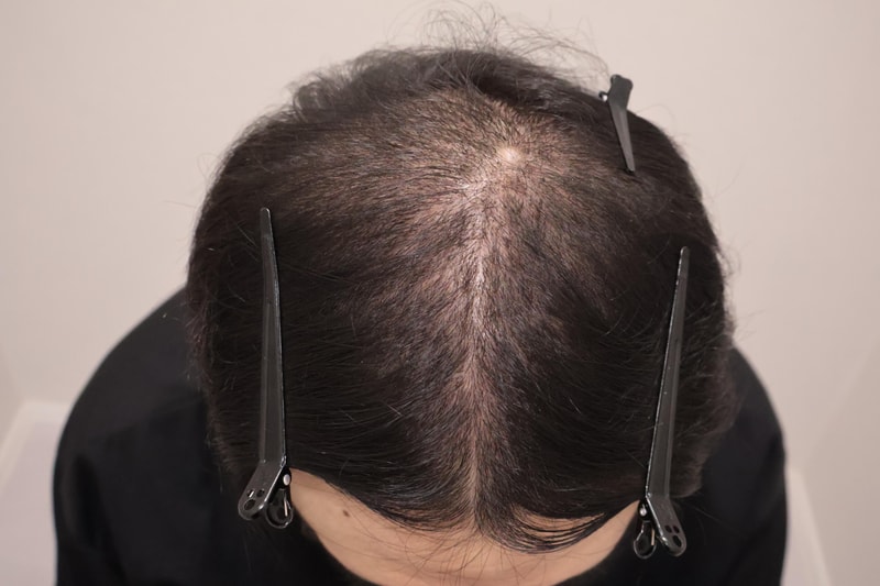 포토후기 이미지