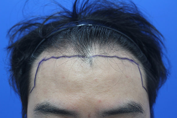 포토후기 이미지