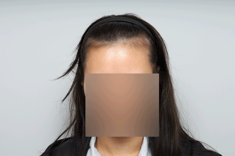 포토후기 이미지