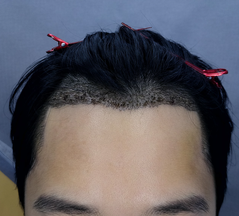 2500모 후.png