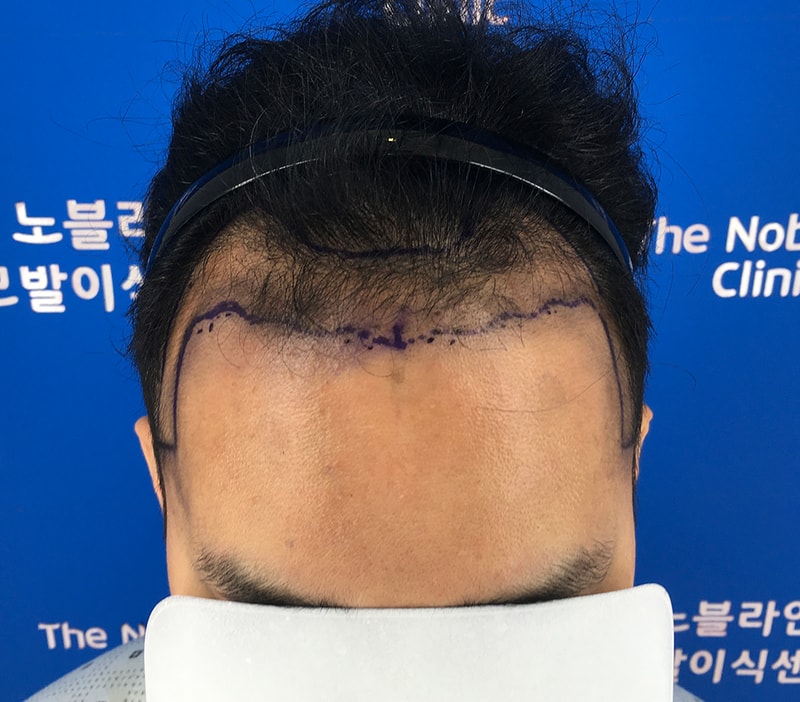 포토후기 이미지