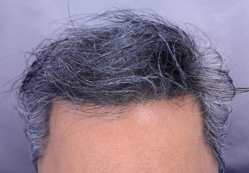장인성 님 6개월.png