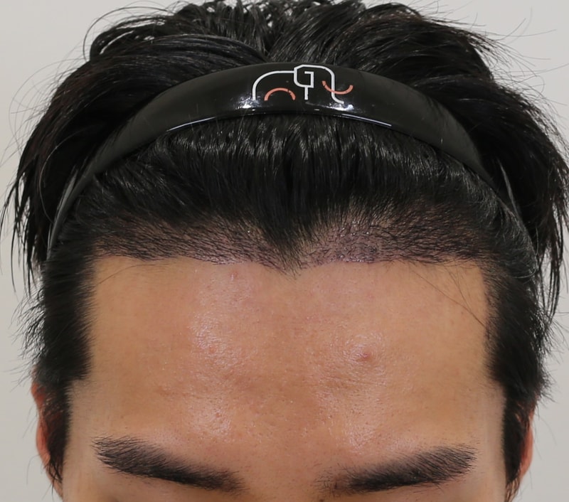 포토후기 이미지