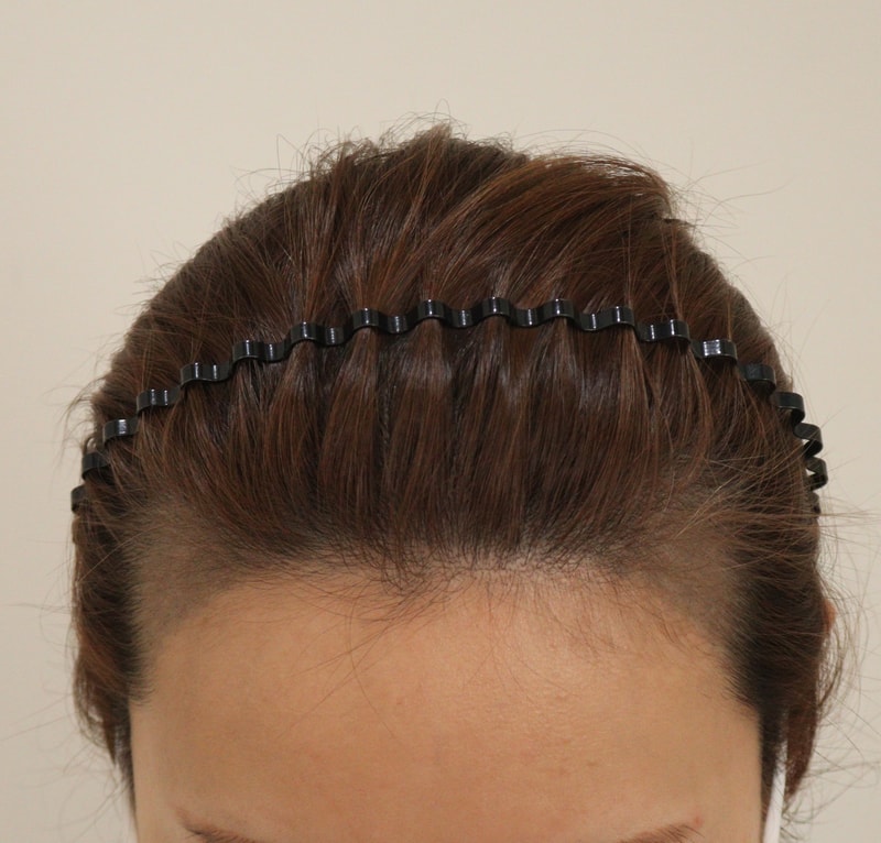 1. 수술전_2.JPG