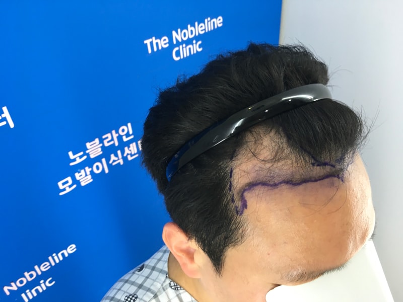 포토후기 이미지
