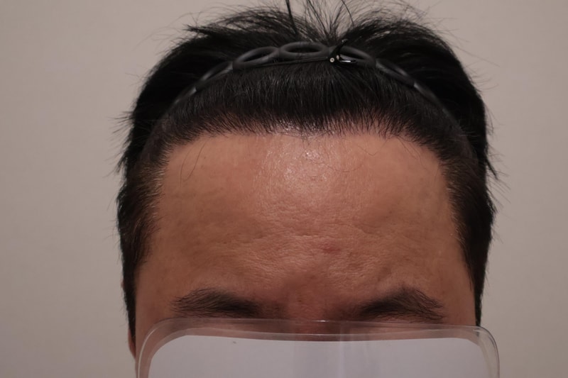 후1.jpg