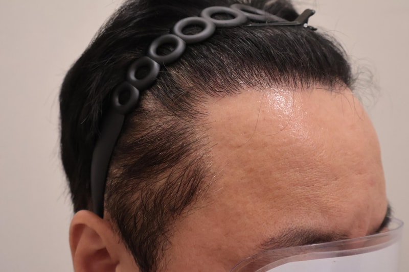 후3.jpg