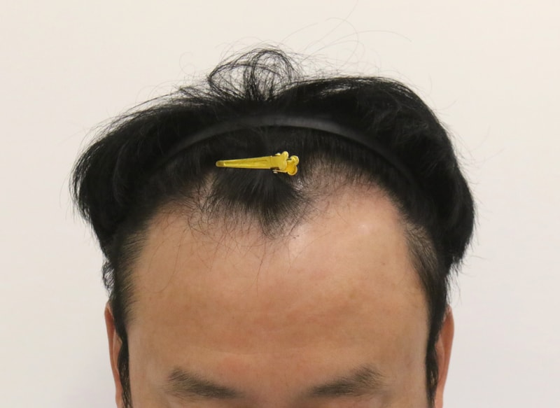 포토후기 이미지