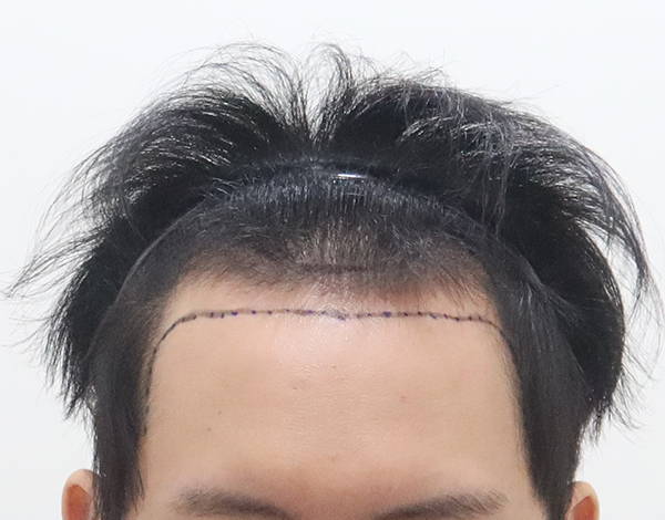 포토후기 이미지
