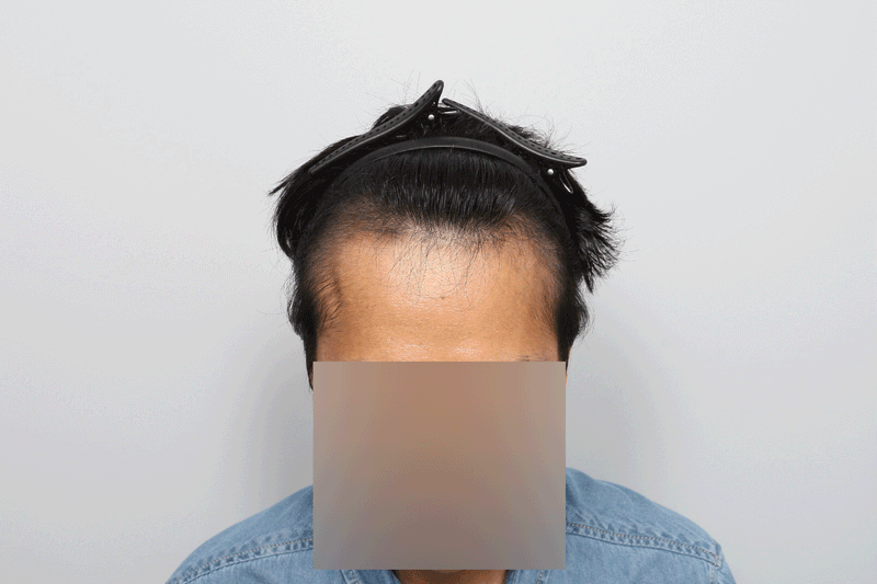 포토후기 이미지