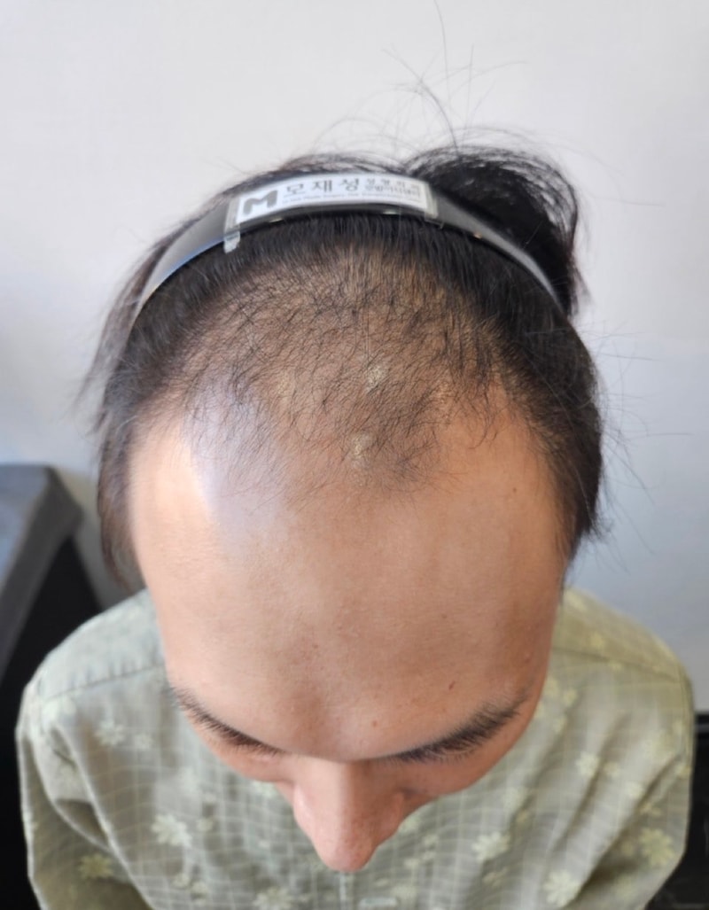 포토후기 이미지
