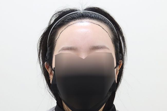 포토후기 이미지
