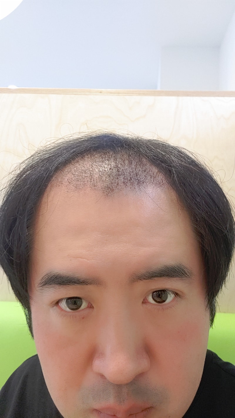 포토후기 이미지