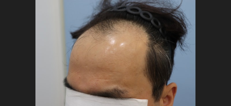 포토후기 이미지