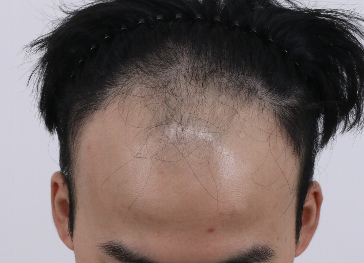 포토후기 이미지