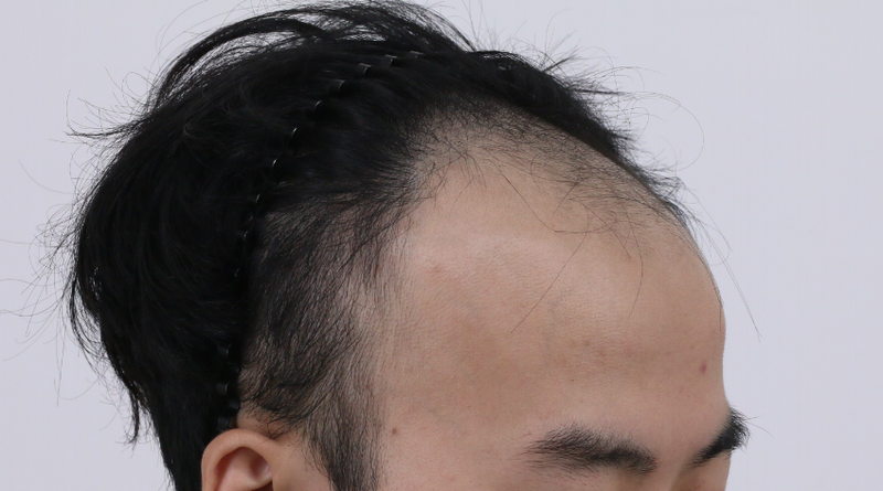 옆.png