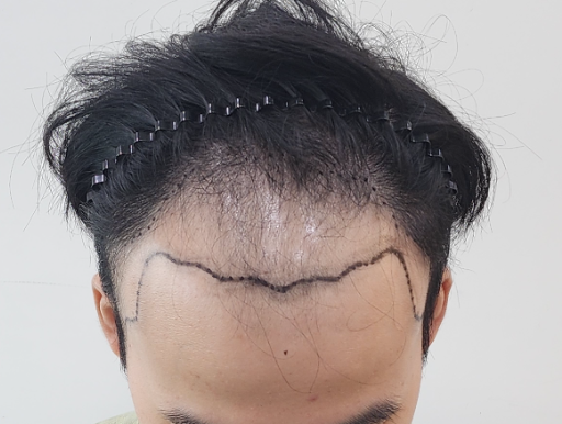 앞.png