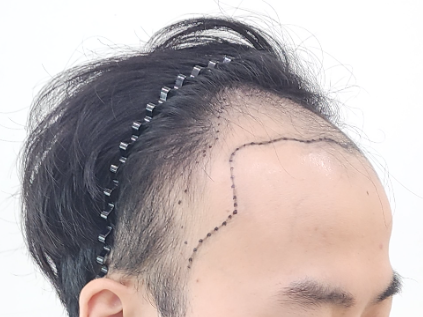 옆.png