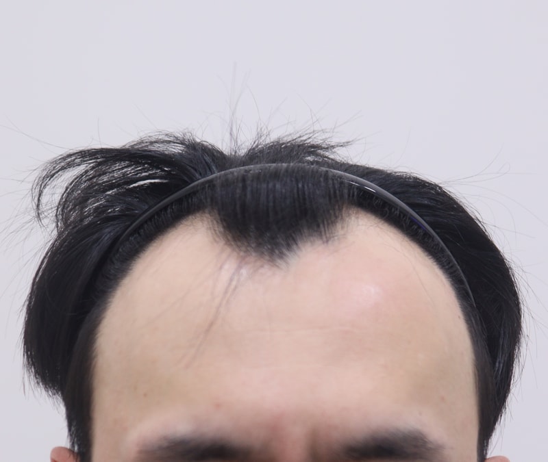 포토후기 이미지